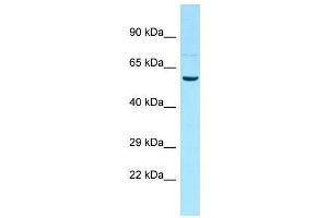 Host:  Rabbit  Target Name:  Ddx19b  Sample Type:  Rat Testis lysates  Antibody Dilution:  1. (DDX19B anticorps  (N-Term))