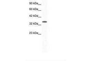 Image no. 1 for anti-Aryl Hydrocarbon Receptor Interacting Protein (AIP) (AA 99-148) antibody (ABIN202263) (AIP anticorps  (AA 99-148))