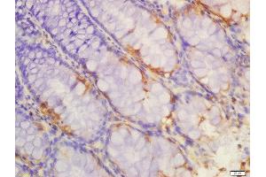Formalin-fixed and paraffin embedded rat colon labeled with Anti-IL-1R2 Polyclonal Antibody, Unconjugated  at 1:200 followed by conjugation to the secondary antibody and DAB staining