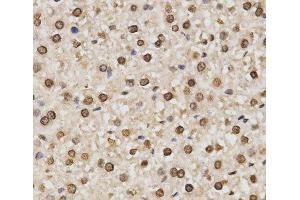 Immunohistochemistry of paraffin-embedded Rat liver using DiMethyl-Histone H3-K14 Polyclonal Antibody at dilution of 1:200 (40x lens).
