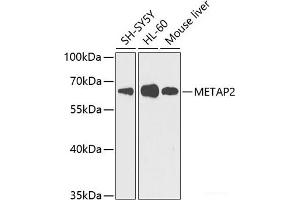 Western blot analysis of extracts of various cell lines using METAP2 Polyclonal Antibody at dilution of 1:1000. (METAP2 anticorps)
