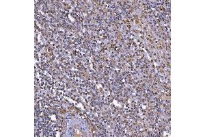 IHC analysis of TOP3B using anti-TOP3B antibody (ABIN7599907). (TOP3B anticorps  (AA 128-824))