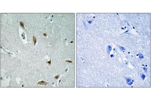 Immunohistochemical staining of paraffin-embedded human brain tissue reacted with AKT1/AKT3 (phospho Y437/Y434) polyclonal antibody  at 1:50-1:100 dilution. (AKT1/3 (pTyr437), (Tyr434) anticorps)