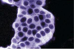 Immunofluorescence staining of PC12 cells.