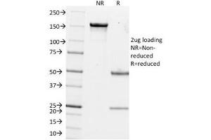 SDS-PAGE Analysis of Purified, BSA-Free Estrogen Inducible Protein pS2 Antibody (clone GE2).