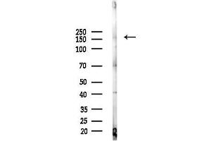 anti-RAB3 GTPase Activating Protein Subunit 2 (Non-Catalytic) (RAB3GAP2) (Internal Region) antibody