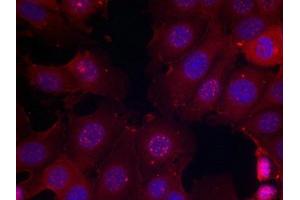 Immunofluorescence staining of methanol-fixed MCF cells using Estrogen Receptor-a(Phospho-Ser167) Antibody.