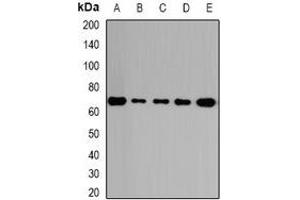 Western blot analysis of GalNAc-T2 expression in HepG2 (A), A431 (B), mouse lung (C), rat kidney (D), rat brain (E) whole cell lysates. (GalNAc-T2 anticorps)