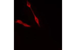 ABIN6274372 staining Hela cells by IF/ICC. (TRIP4 anticorps  (N-Term))