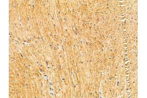 ABIN7094321 and ABIN7098368 at 1/100 staining Mouse heart tissue by IHC-P. (KIF19 anticorps  (Internal Region))
