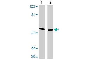 Western blot analysis of DAPK3 expression in HeLa (lane 1) and Jurkat (lane 2) whole cell lysates probed with DAPK3 polyclonal antibody . (DAPK3 anticorps  (AA 279-298))