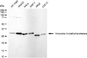 anti-Thiopurine S-Methyltransferase (TPMT) antibody
