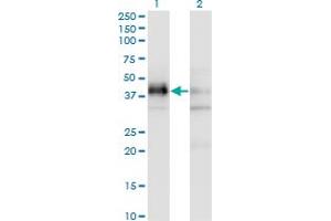 Western Blot analysis of SFRS5 expression in transfected 293T cell line by SFRS5 monoclonal antibody (M03A), clone 2C8. (SRSF5 anticorps  (AA 1-272))