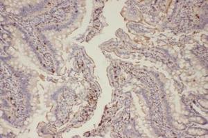 Immunohistochemical analysis of paraffin-embedded Rat Colorectal tissue using EGFR (Phospho-Thr678) Antibody. (EGFR anticorps  (pThr678))