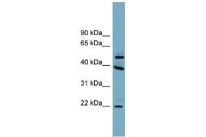 WB Suggested Anti-C4orf20 Antibody Titration: 0. (UFSP2 anticorps  (Middle Region))