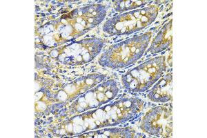 Immunohistochemistry of paraffin-embedded rat intestine using HPGD antibody (ABIN2563240) at dilution of 1:100 (40x lens). (HPGD anticorps)