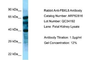 Western Blotting (WB) image for anti-F-Box and Leucine-Rich Repeat Protein 8 (FBXL8) (N-Term) antibody (ABIN2789254)