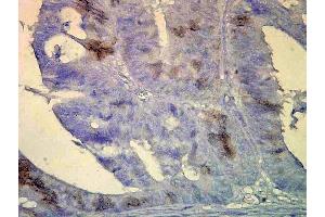 Immunohistochemistry analysis using Mouse Anti-Hsp70 Monoclonal Antibody, Clone BB70 . (HSP70/HSC70 anticorps  (Atto 488))