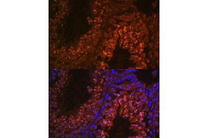 Immunofluorescence analysis of mouse testis using UBQLN3 antibody (ABIN7271123) at dilution of 1:100. (Ubiquilin 3 anticorps  (AA 306-620))