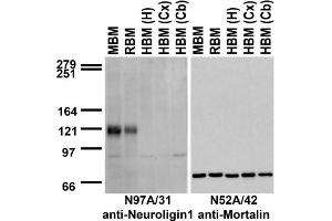 Immunoblot against crude membranes from whole mouse (MBM) or rat (RBM) brain and from human hippocampus [HBM(H)], cerebral cortex [HBM(Cx)] or cerebellum [HBM(Cb)] probed with N97A/31 (left) or N52A/42 (right) TC supe.