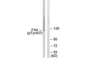 Western blot analysis of extracts from COS7 cells treated with EGF 200ng/ml 30', using FAK (Phospho-Tyr407) Antibody. (FAK anticorps  (pTyr407))