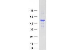 Validation with Western Blot