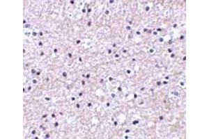 Immunohistochemistry of IEX-1 in human liver tissue with IEX-1 antibody at 2.