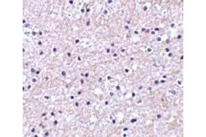 Immunohistochemistry of IEX-1 in human liver tissue with IEX-1 antibody at 2. (IER3 anticorps  (Center))