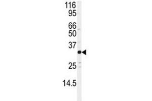 Western blot analysis of JUND antibody and Jurkat lysate