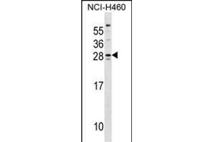 SH3BGR Antibody (Center) (ABIN1537875 and ABIN2848568) western blot analysis in NCI- cell line lysates (35 μg/lane). (SH3BGR anticorps  (AA 149-177))