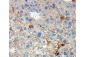 Used in DAB staining on fromalin fixed paraffin-embedded liver tissue