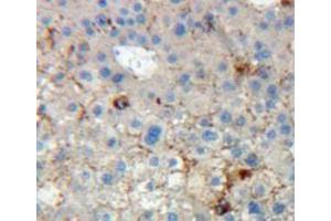 Used in DAB staining on fromalin fixed paraffin-embedded liver tissue (KIR2DL5A anticorps  (AA 22-375))