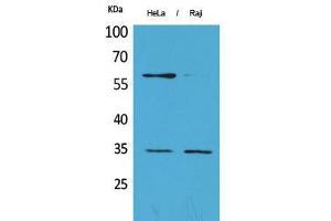 Western Blotting (WB) image for anti-Fc gamma RII (CD32) (C-Term) antibody (ABIN3178160) (Fc gamma RII (CD32) (C-Term) anticorps)