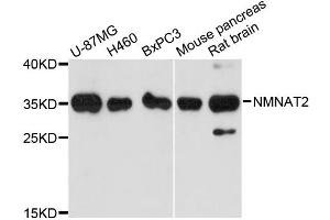 Western blot analysis of extracts of various cell lines, using NMNAT2 antibody (ABIN6291178) at 1:3000 dilution. (NMNAT2 anticorps)
