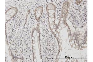 Immunoperoxidase of monoclonal antibody to C1D on formalin-fixed paraffin-embedded human colon.