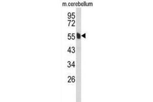 Western Blotting (WB) image for anti-Membrane Protein, Palmitoylated 6 (MAGUK P55 Subfamily Member 6) (MPP6) antibody (ABIN3004081) (MPP6 anticorps)