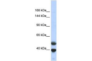 Host:  Rabbit  Target Name:  PRDM7  Sample Type:  Fetal Lung lysates  Antibody Dilution:  1. (PRDM7 anticorps  (N-Term))
