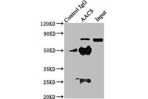 Immunoprecipitating AACS in HEK293 whole cell lysate Lane 1: Rabbit control IgG instead of ABIN7142936 in HEK293 whole cell lysate. (AACS anticorps  (AA 435-598))