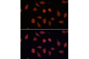 Immunofluorescence analysis of L929 cells using KCN antibody (ABIN7269481) at dilution of 1:100. (KCNAB2 anticorps  (AA 1-40))