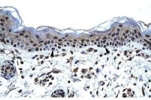 Human Skin; ZNFN1A5 antibody - N-terminal region in Human Skin cells using Immunohistochemistry (IKZF5 anticorps  (N-Term))