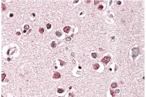 P32034PU-N Endophilin-A1 Antibody staining of paraffin embedded Human Cerebral Cortex. (SH3G2 anticorps  (Internal Region))