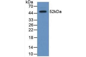 Detection of Recombinant SAP, Human using Polyclonal Antibody to Serum Amyloid P Component (SAP) (APCS anticorps  (AA 23-223))