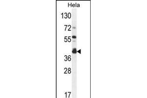 DEGS2 Antibody (C-term) (ABIN654539 and ABIN2844256) western blot analysis in Hela cell line lysates (35 μg/lane). (DEGS2 anticorps  (C-Term))