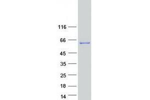 Validation with Western Blot