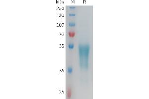 Human Protein, hFc Tag on SDS-PAGE under reducing condition.