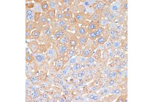 Immunohistochemistry of paraffin-embedded mouse liver using APCS antibody (ABIN3022713, ABIN3022714, ABIN3022715, ABIN1512583 and ABIN6219158) at dilution of 1:100 (40x lens).