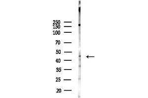 anti-Mitochondrial Transcription Termination Factor (MTERF) (Internal Region) antibody