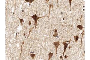 ABIN6266924 at 1/100 staining human brain tissue sections by IHC-P.