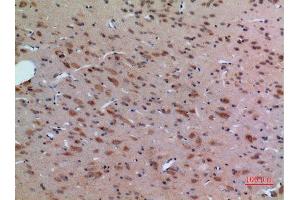 Immunohistochemistry (IHC) analysis of paraffin-embedded Rat Brain, antibody was diluted at 1:100.