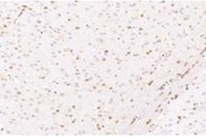 Immunohistochemistry analysis of paraffin-embedded mouse striatum using,CYPIVF11 (ABIN7073679) at dilution of 1: 12000 (CYP4F11 anticorps)